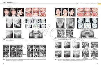 TMJ 1st Orthodontics Concepts, Mechanics, and Stability