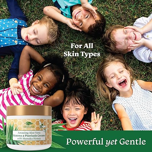 Miniatura 5 de Manuka Honey Eczema Cream Loción hidratante sin fragancia para aliviar la psoriasis - Pomada para erupciones cutáneas secas y con picazón -