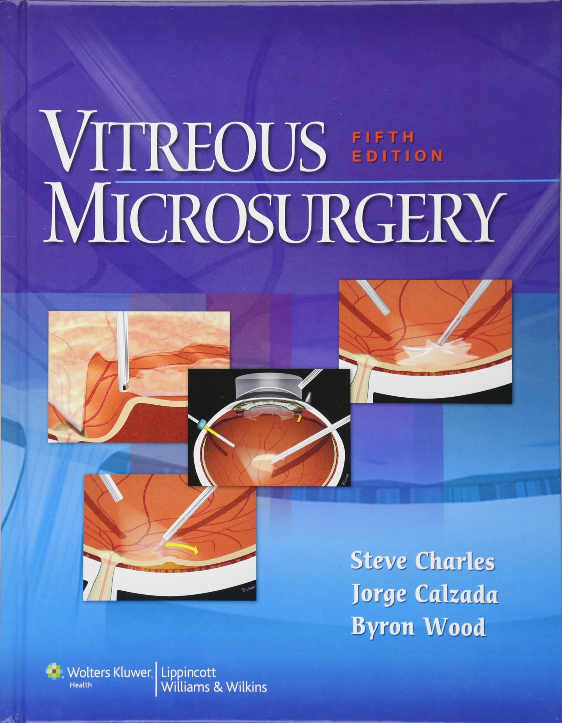 健康・医学 Vitreous Microsurgery Vitreous Microsurgery: 9781608315031: Medicine & Health Science