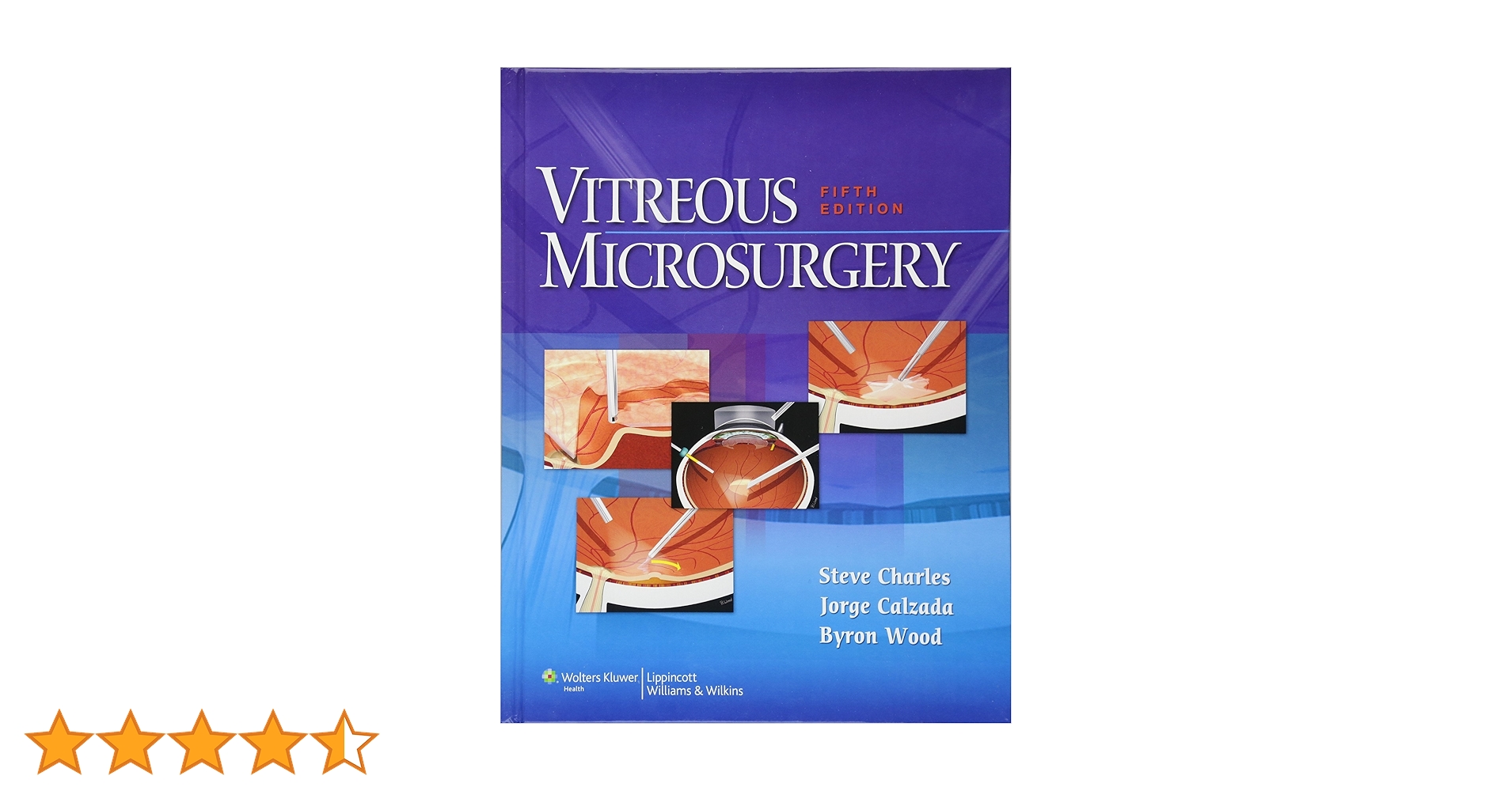 健康・医学 Vitreous Microsurgery Vitreous Microsurgery: 9781608315031: Medicine & Health