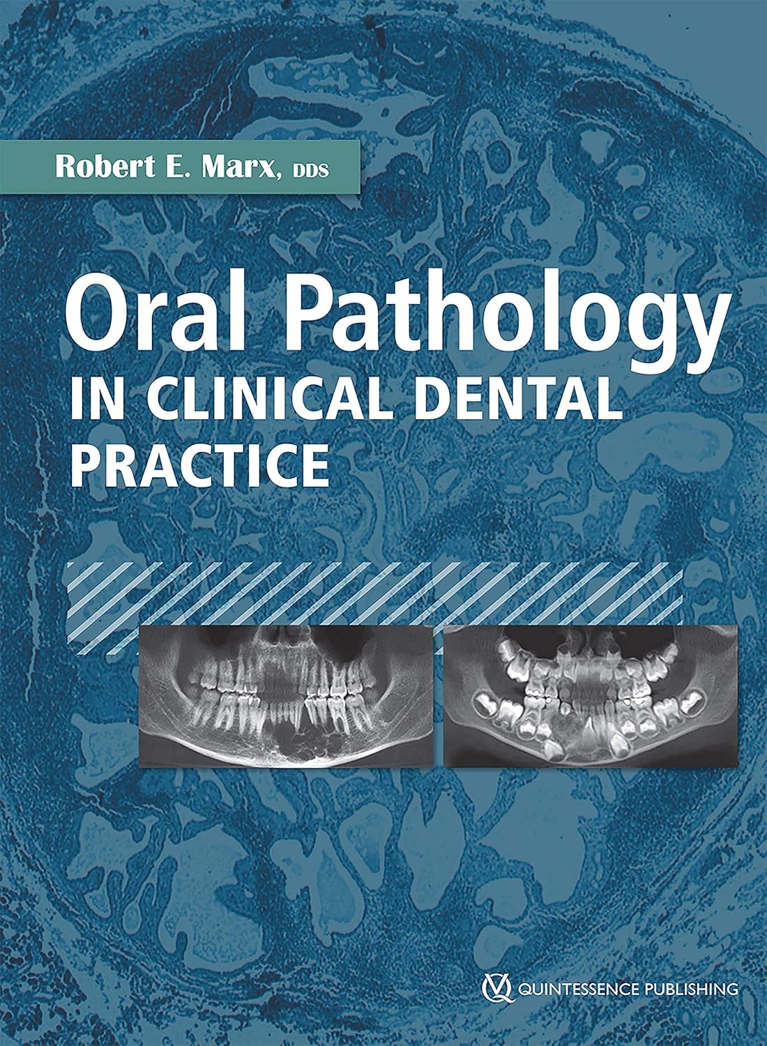 Oral Pathology in Clinical Dental Practice      Kindle Edition