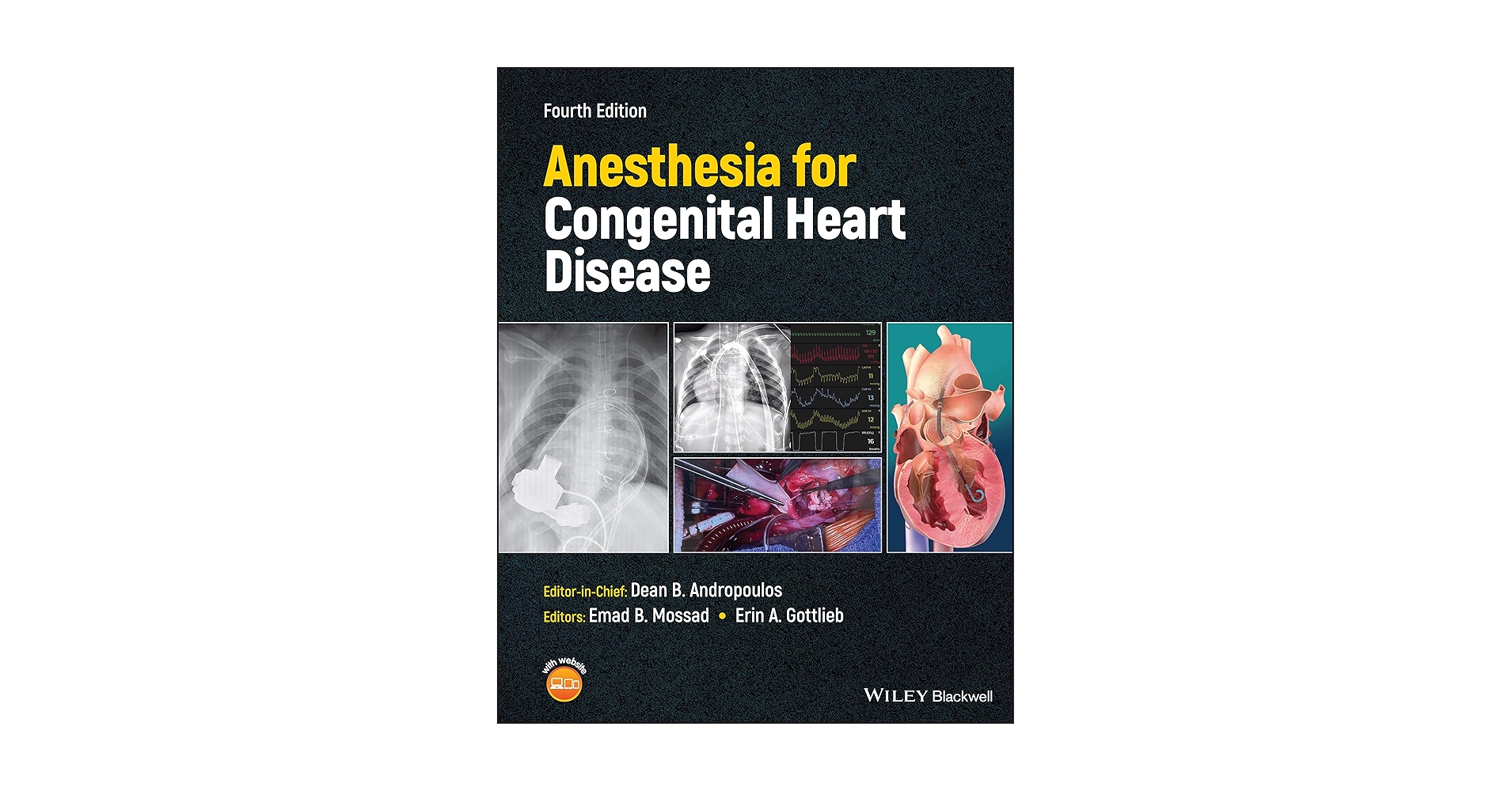 Anesthesia for CongenitalHeartDisease第三版 Anesthesia for Congenital Heart Disease: Andropoulos, Dean B