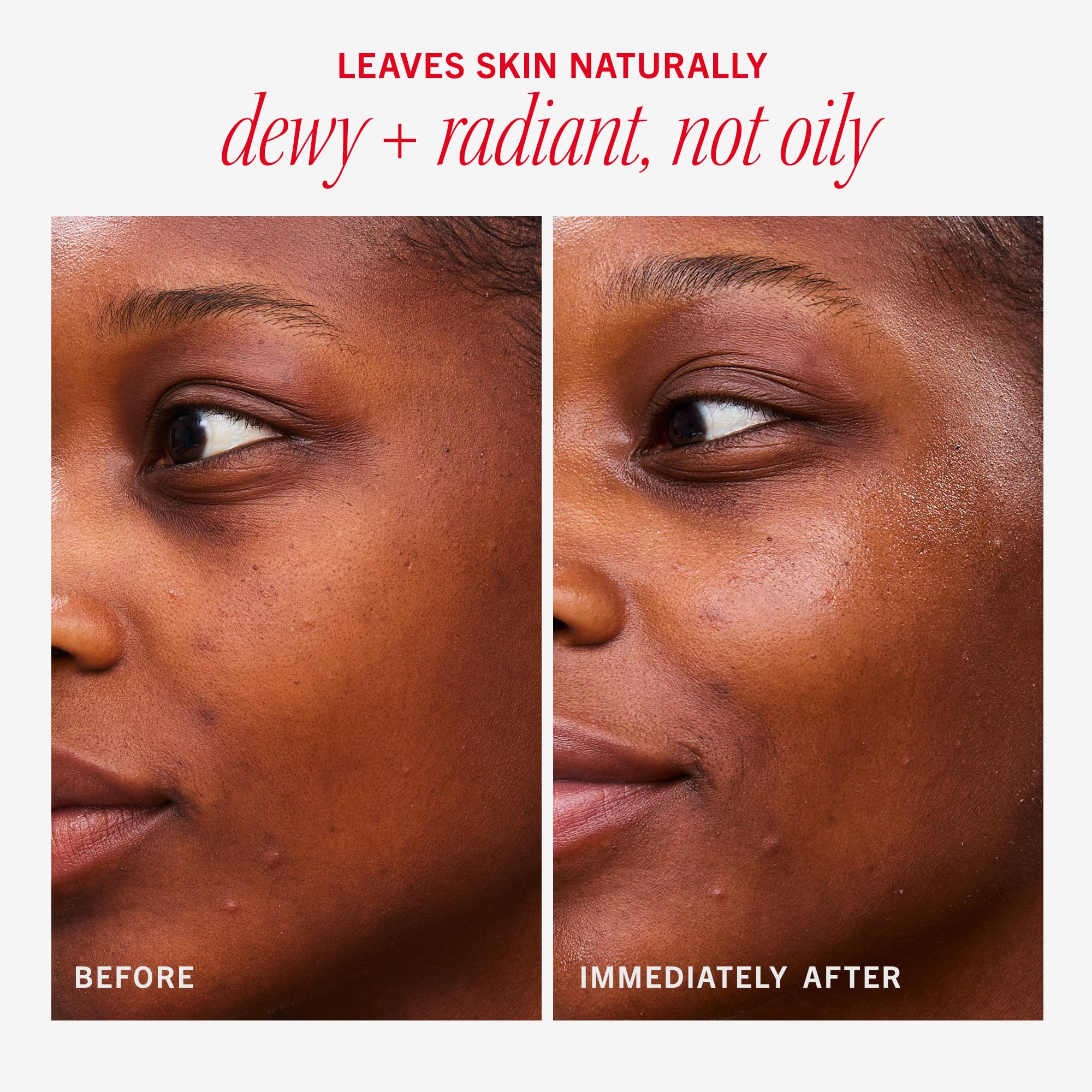 First Aid Beauty - Hydrating Dewy Gel Cream, Lightweight Oil-Free Facial Moisturizer with Hyaluronic Acid and Ceramides, Helps Reduce Excess Oil Build Up & Improve Skins Hydration, 1.9 FL oz