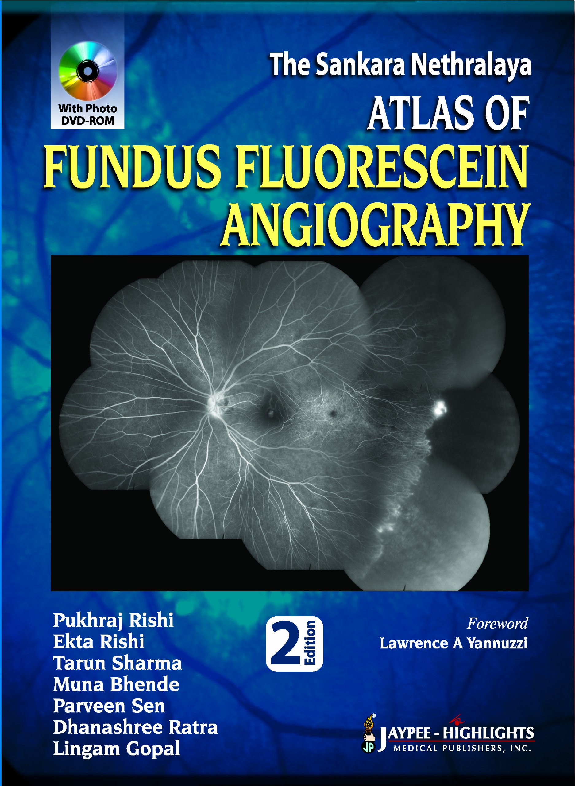 Jaypee Brothers Medical Publishers Atlas of Fundus Fluorescein Angiography