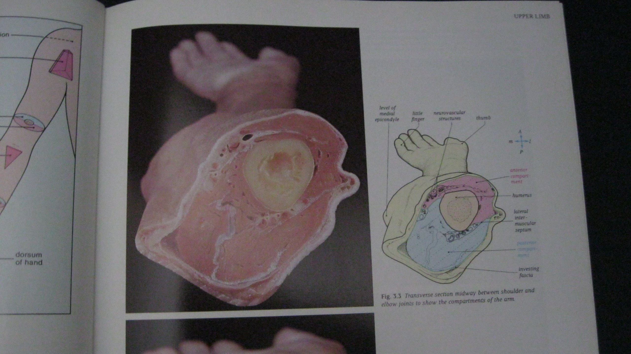 Atlas Human Anatomy & Integ Text