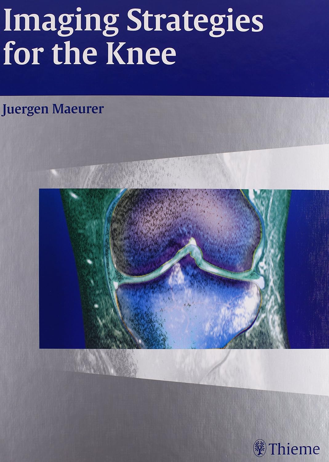 Imaging Strategies for the Knee: 9781588904492: Medicine & Health ...
