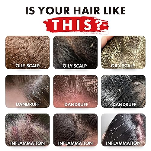 Miniatura 2 de ALFHEIM Rosemary+ - Juego de champú y acondicionador purificante Cuidado equilibrante para cabello graso y fino con aceites de romero, menta y