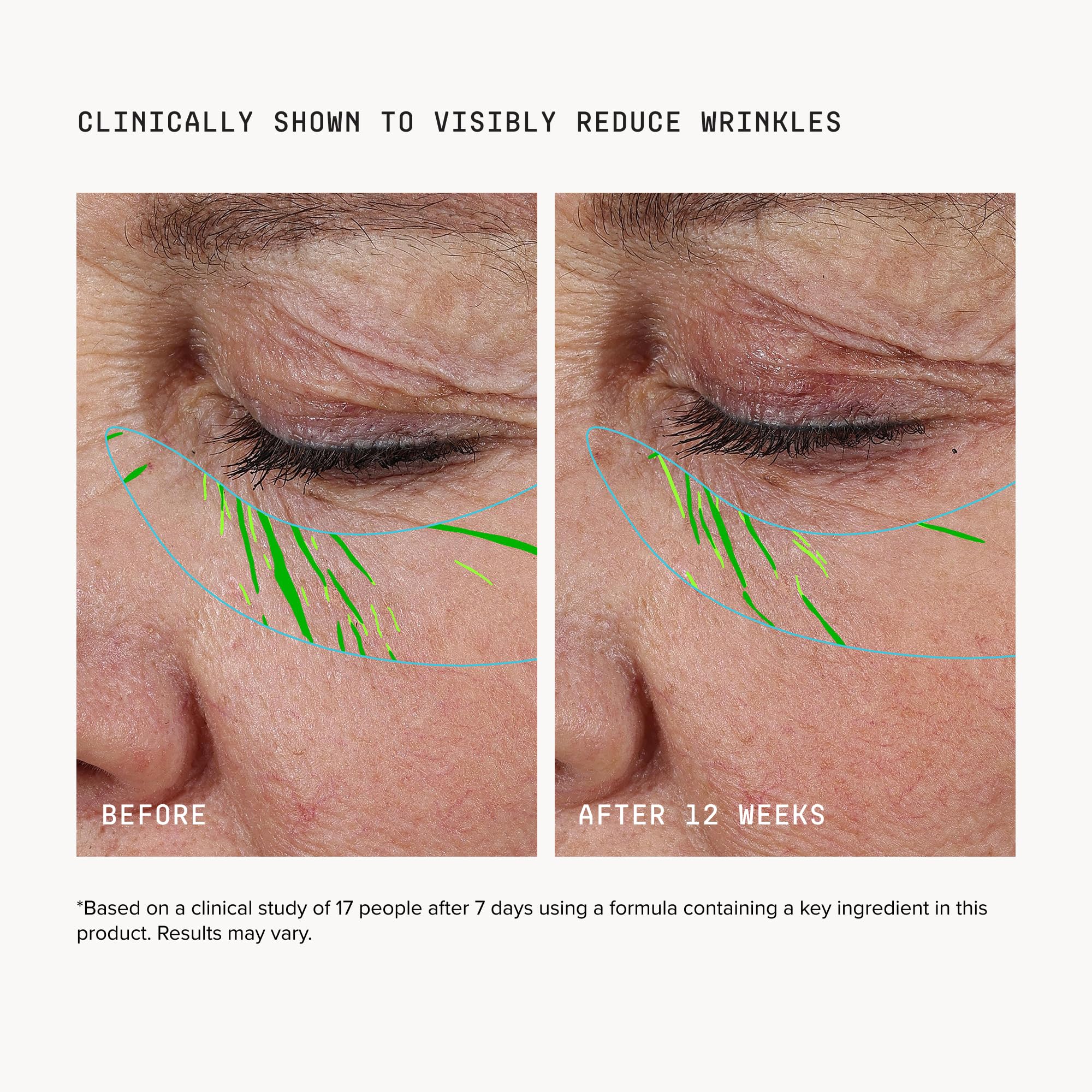 DRMTLGY Needle-less Growth Factor Serum | Firming Lifting Face Serum