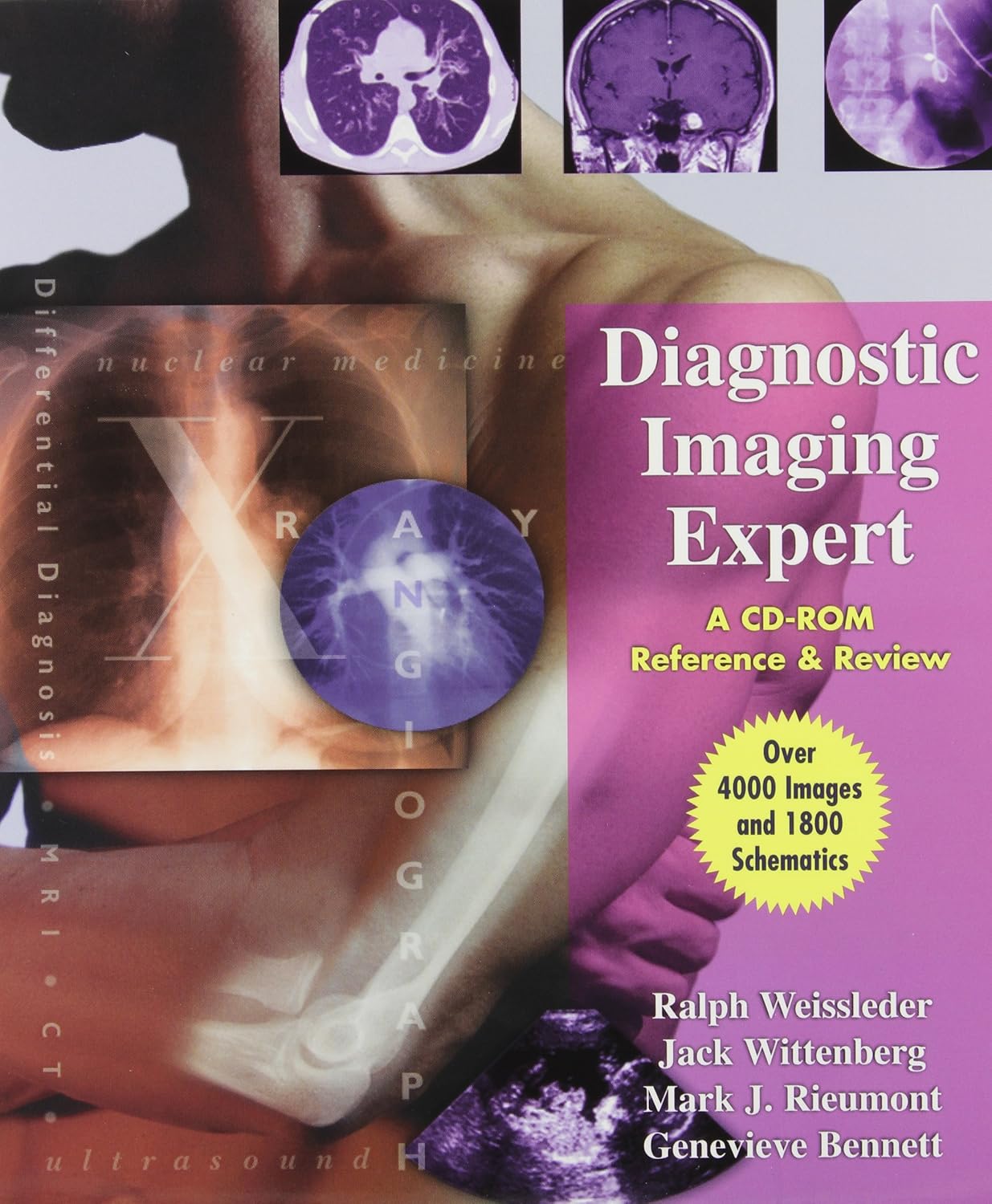 Amazon Diagnostic Imaging Expert A CDROM Reference and Review Weissleder MD PhD, Ralph