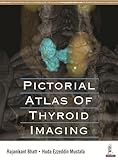 Pictorial Atlas of Thyroid Imaging