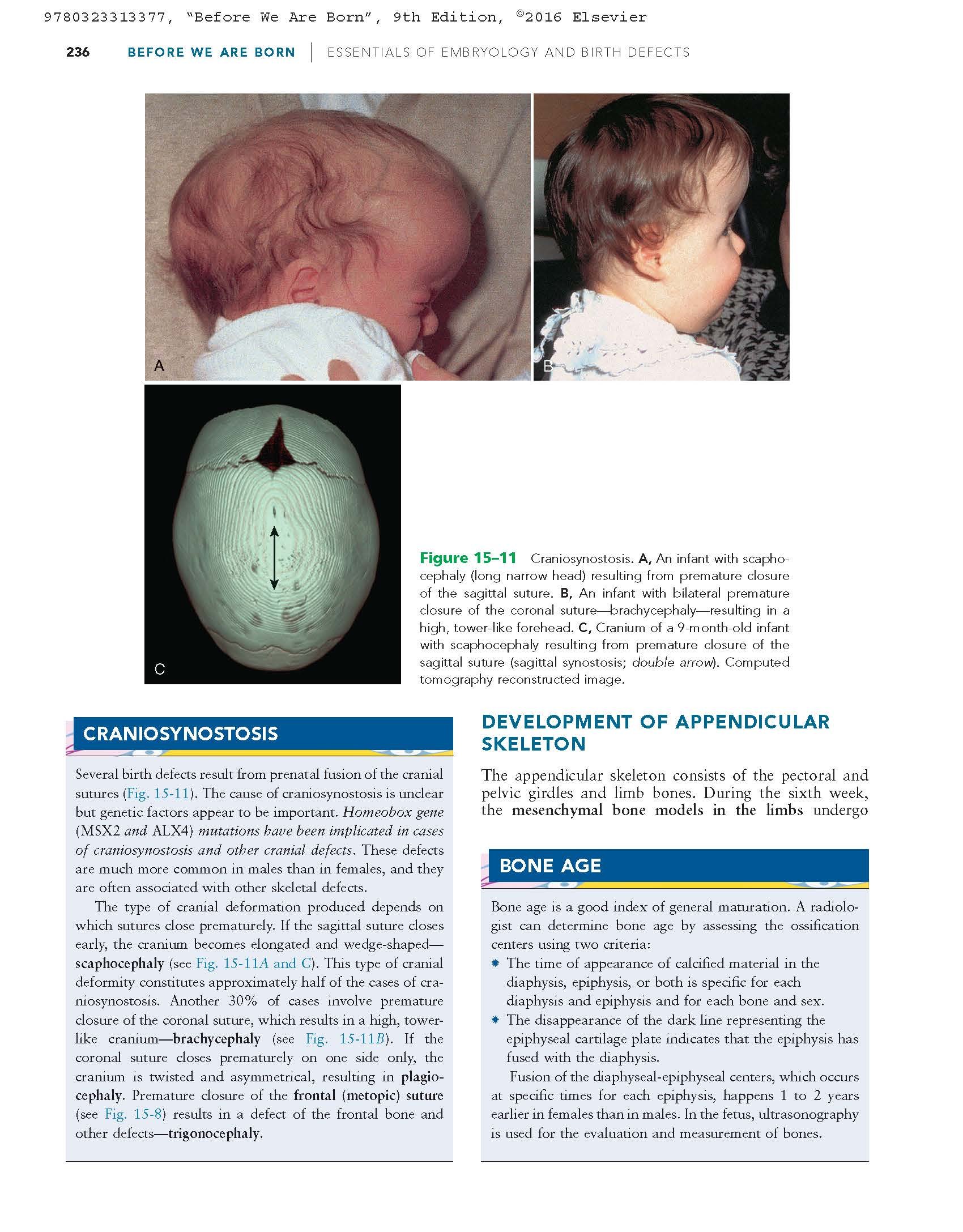 Before We Are Born: Essentials of Embryology and Birth Defects