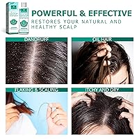 Vista 4 de Roycederm Champú anticaspa, Tratamiento de la caspa para cabello graso, Tratamiento seco del cuero cabelludo escamoso, Champú de cuero cabelludo