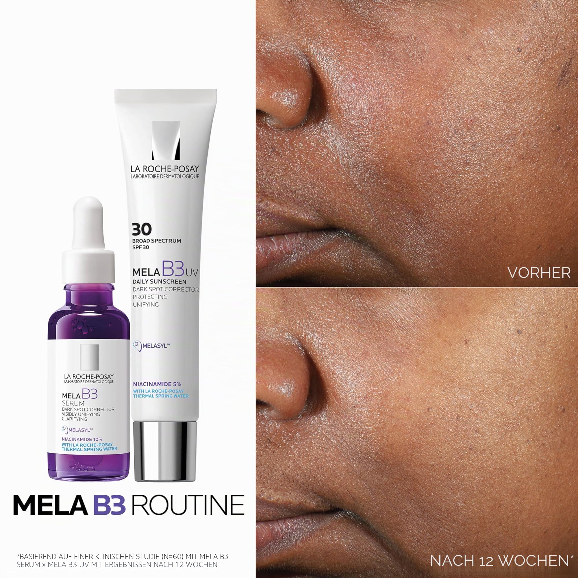 La Roche Posay Anti-Pigmentflecken-Serum für jede Haut, Mildert dunkle Flecken, Pigmentflecken, Altersflecken, Pickelmale, Anti-Rückfall-Wirkung, Mit Melasyl und Niacinamid, Mela B3, 30 ml
