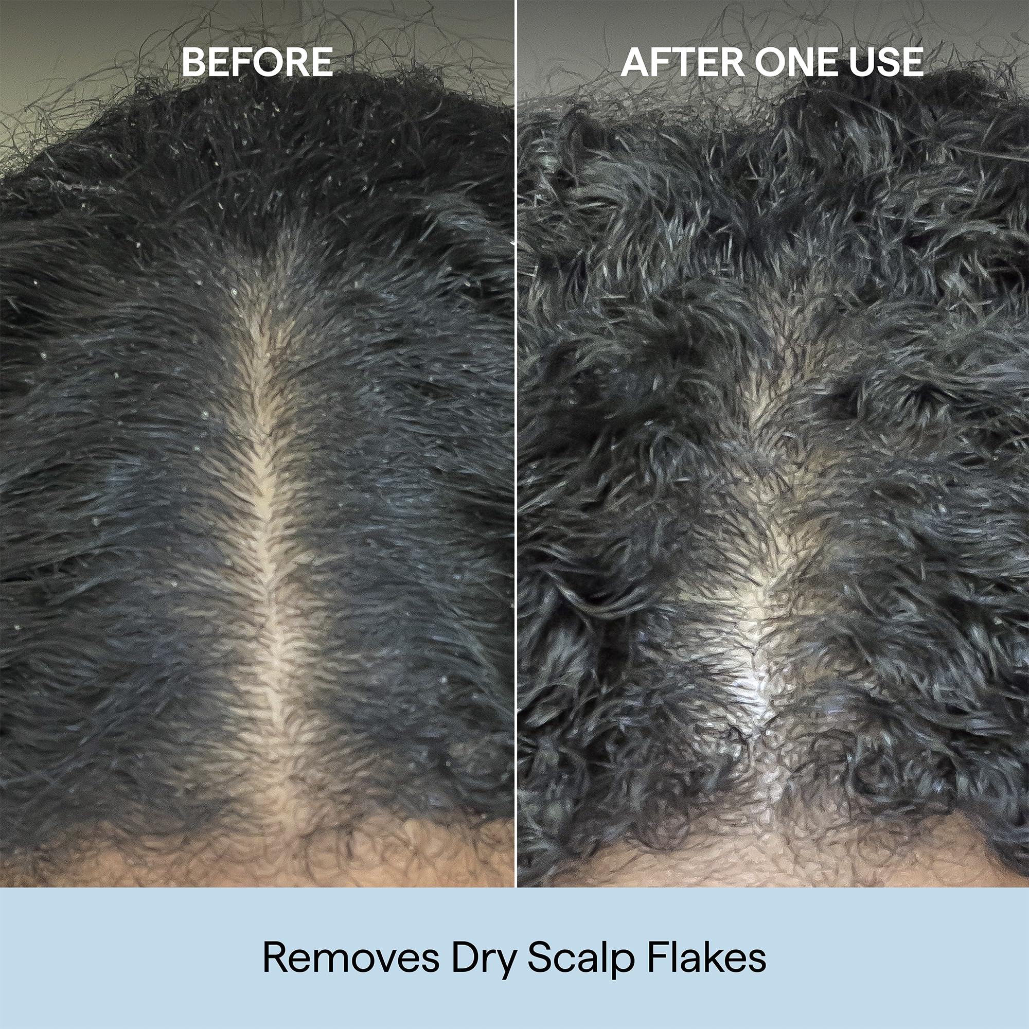 Briogeo Scalp Revival Charcoal Coconut Oil Micro-Exfoliating Shampoo | Sulfate-Free Scalp Scrub for Dry Itchy or Oily Scalp | Detoxifying & Hydrating | Vegan & Cruelty Free product thumbnail 5