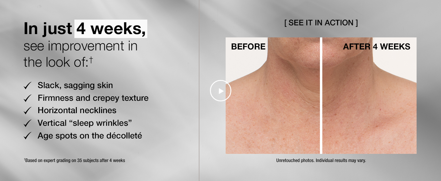 StriVectin Tighten and Lift Advanced Neck Cream PLUS, 0.25 oz for Tightening and Firming Neck and Décolleté Lines, Visibly Reducing Sagging and Crepey Skin for Smooth Healthy Looking Skin