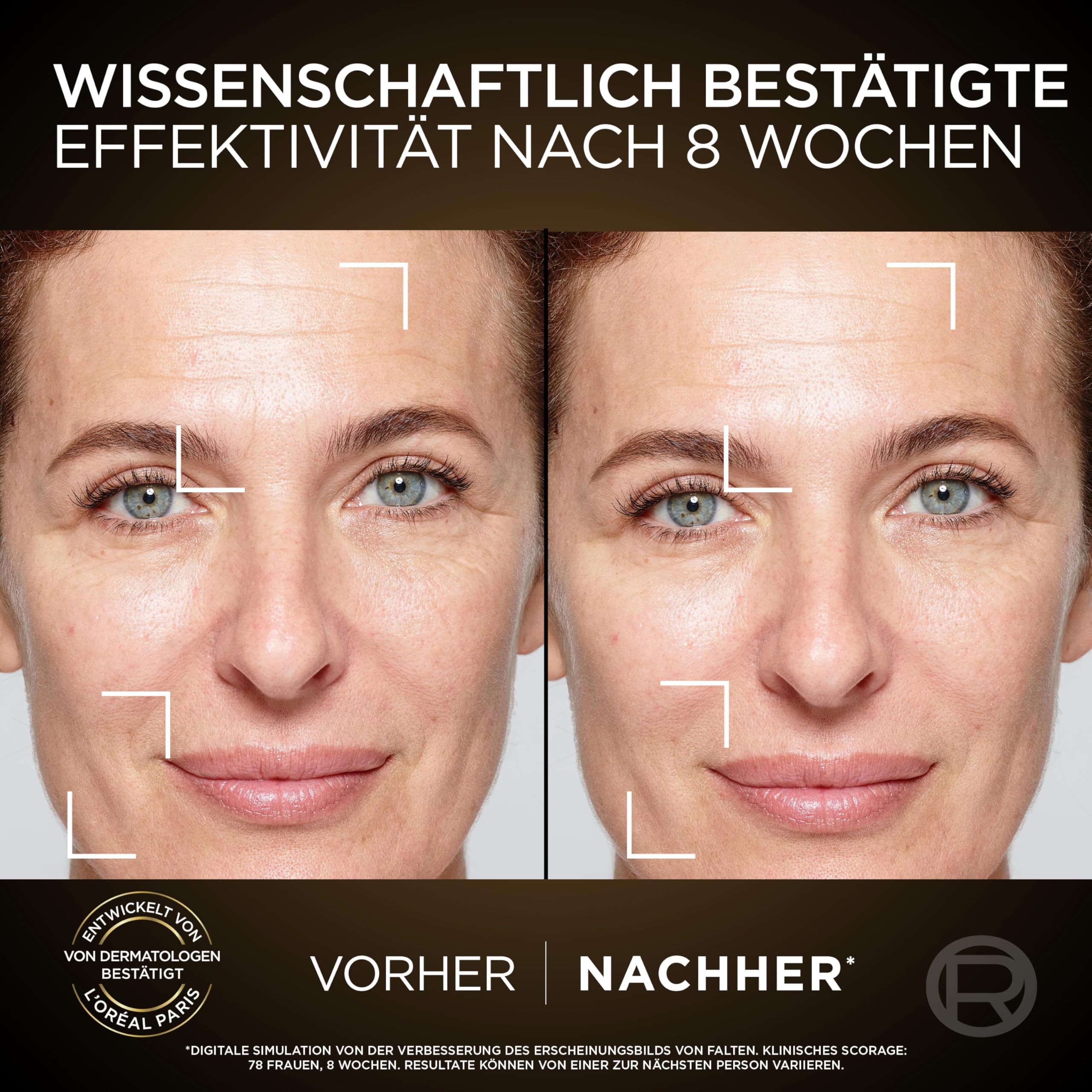 L'Oréal Paris Zestaw do pielęgnacji twarzy, pielęgnacja na dzień i na noc, wspomaga regenerację komórek, z formułą przeciwutleniaczy i witaminą E, Age Perfect Cell, Renesans 2 x 50 ml