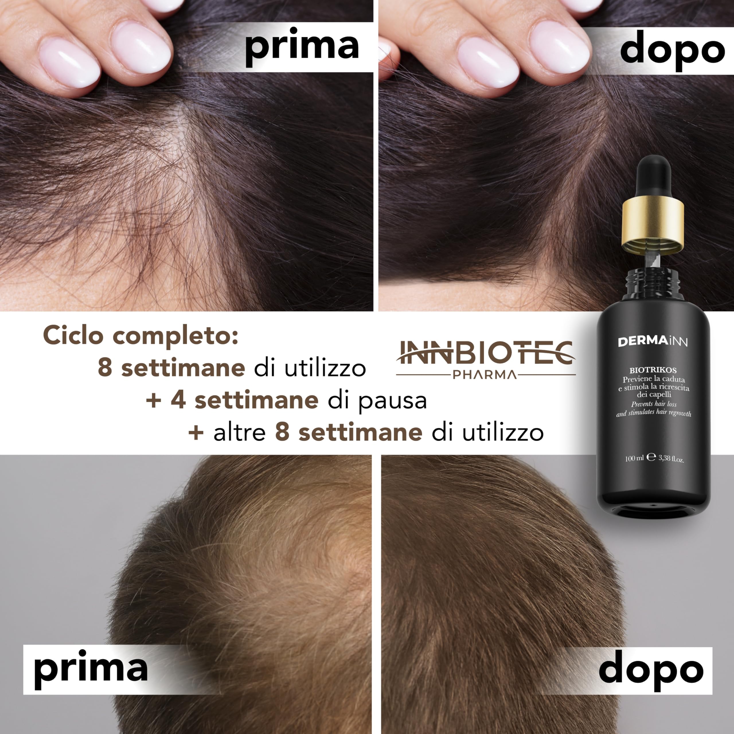 Biotrikos Fiale Anticaduta Capelli Donna e Uomo - Siero Crescita Capelli, Lozione Anticaduta e Ricrescita Capelli per Uomo e Donna, Olio Crescita Capelli, Siero Notte per Capelli