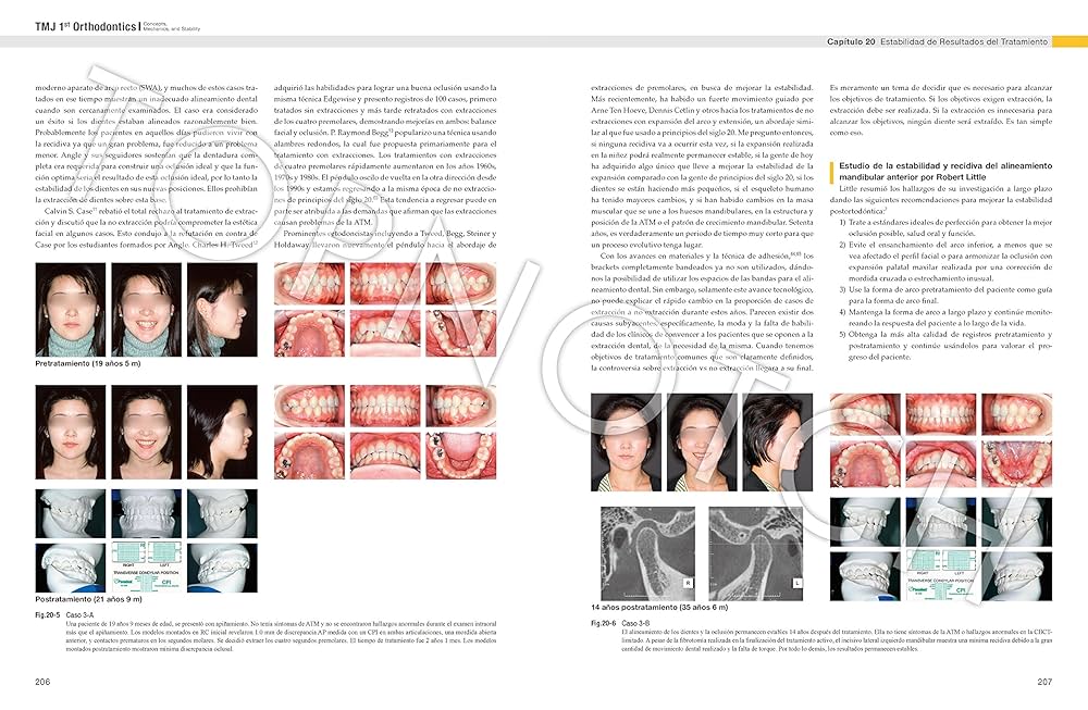 その他 244 TMJ 1st Orthodontics Concepts,Mechan TMJ 1st Orthodontics Concepts, Mechanics, and Stability