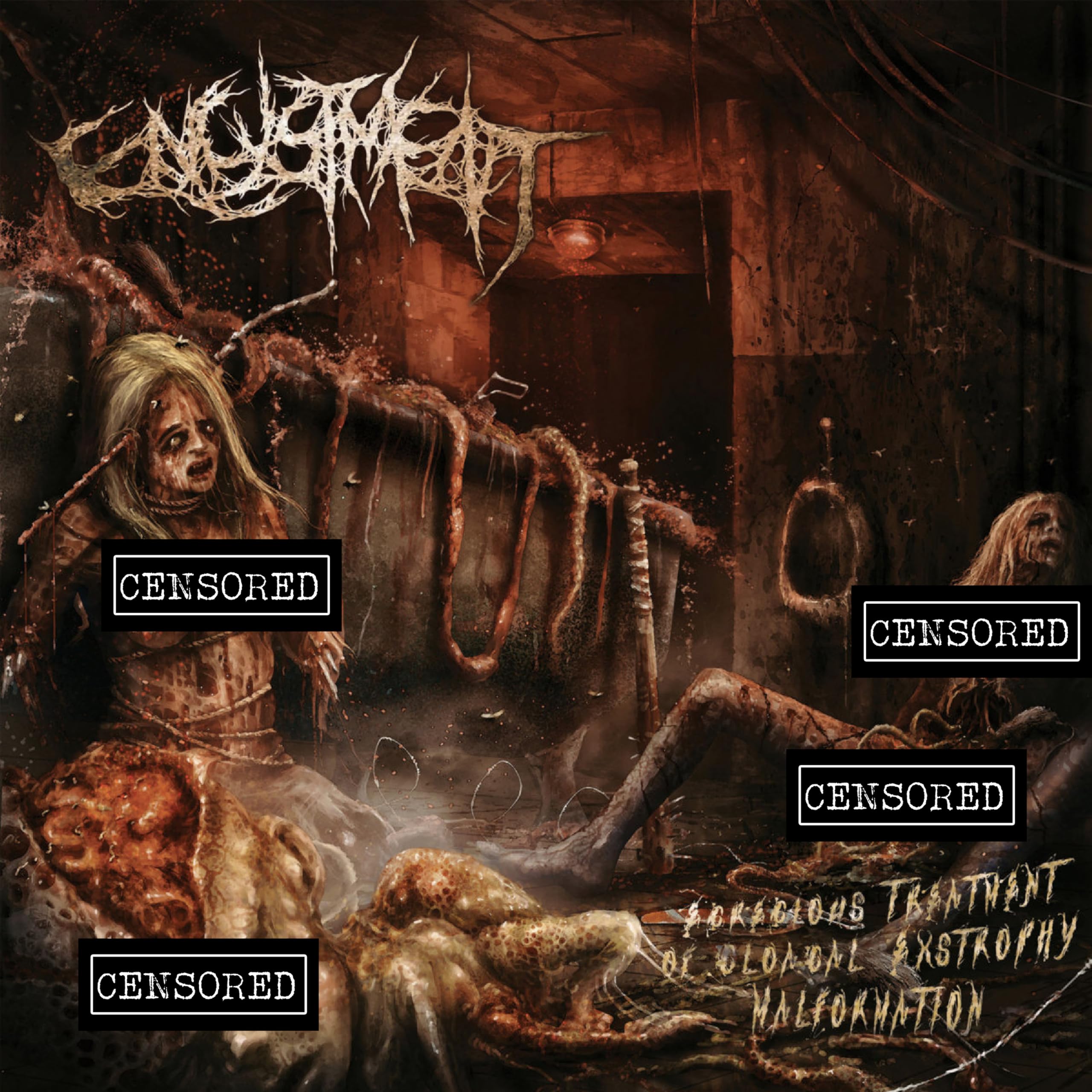 Encystment Egregious Treatment Of Cloacal Extrophy Malformation CD New 760137132