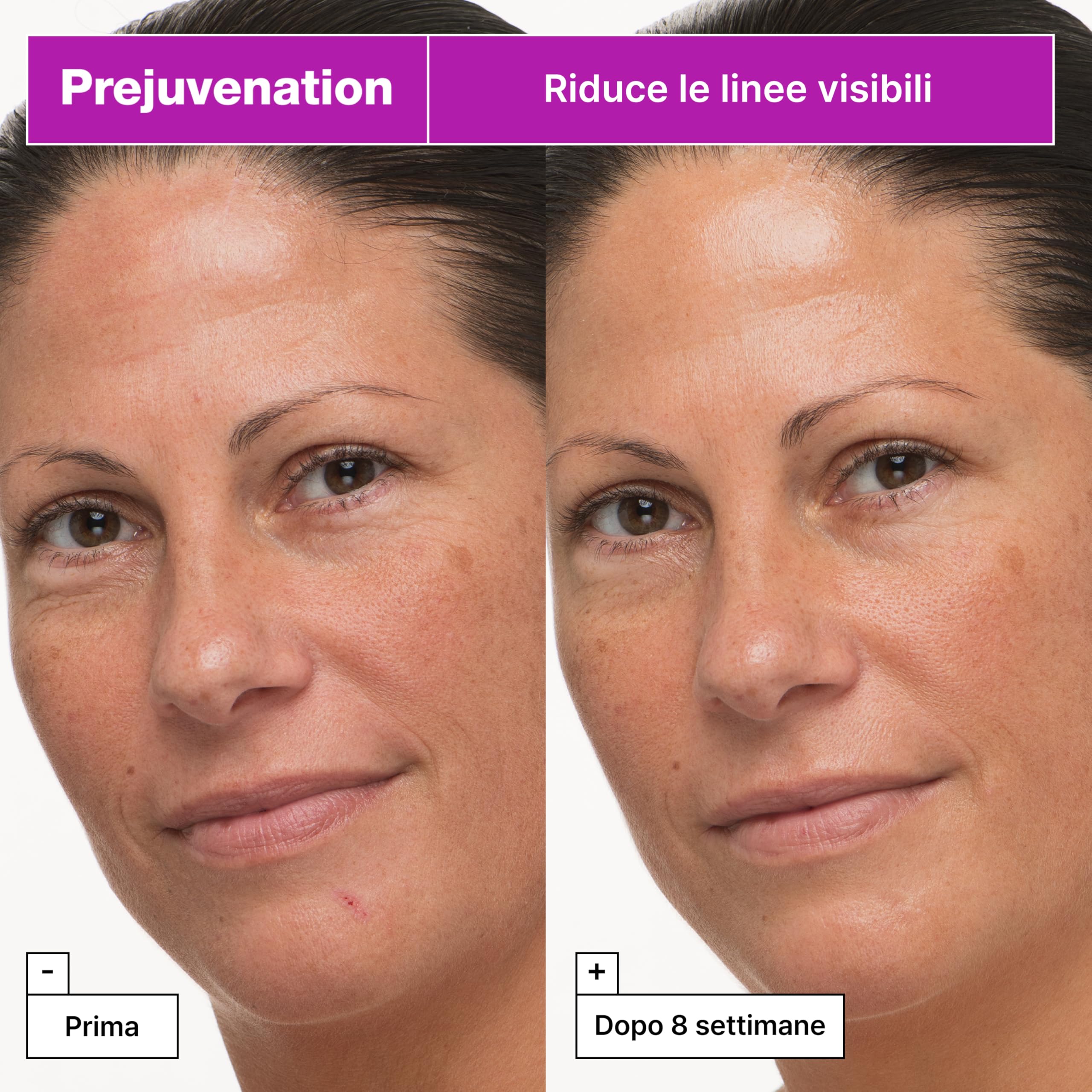Dr.Jart+ Prejuvenation Crema Rassodante Viso 50 ml | Per la Prevenzione Dei Segni Dell’invecchiamento - Crema Viso Anti-Età - Firming Bakuchiol Cream - Skincare Coreana