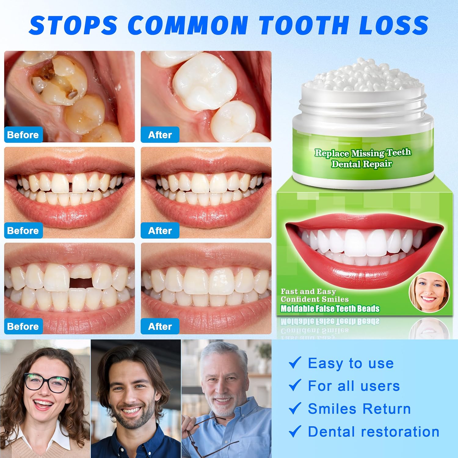 Temporary Tooth Repair Kit, Moldable False Teeth Beads | Fix Broken, Chipped, or Missing Teeth, Cavity Fillings & Loose Dentures in Minutes at Home – Smile with Confidence