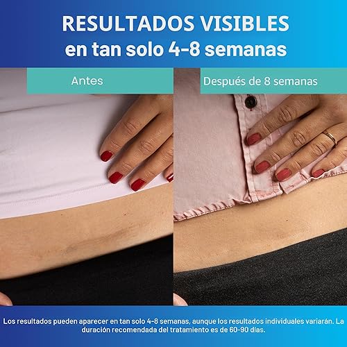 Miniatura 4 de ScarAway, láminas de silicona transparentes avanzadas para cicatrices, tiras de silicona de grado médico (1.5" x 3") para tratamiento y prevención