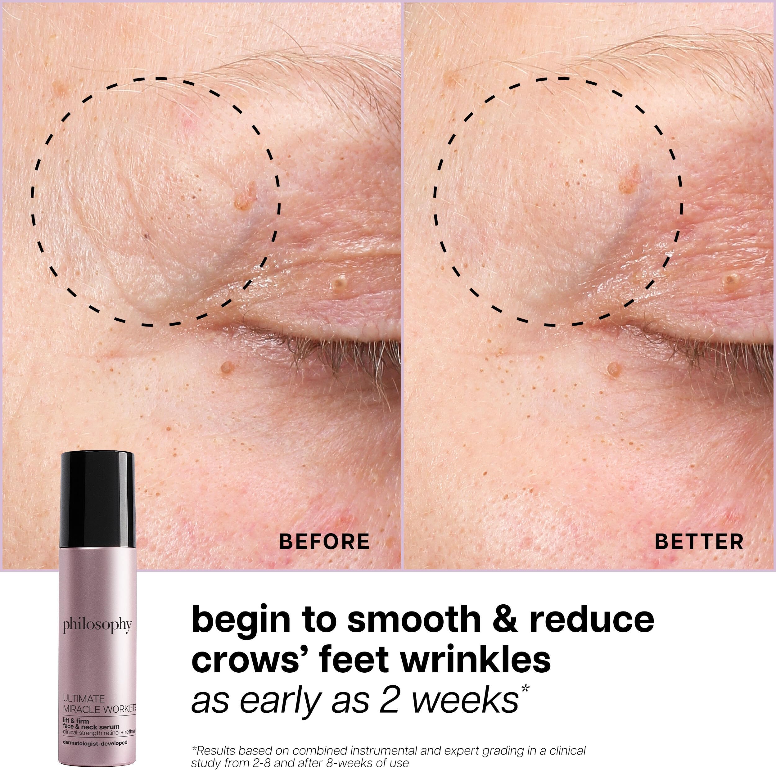 philosophy ultimate miracle worker lift & firm face & neck serum – with encapsulated retinol & retinal ­– anti-aging serum ­– peptide complex – for all skin types