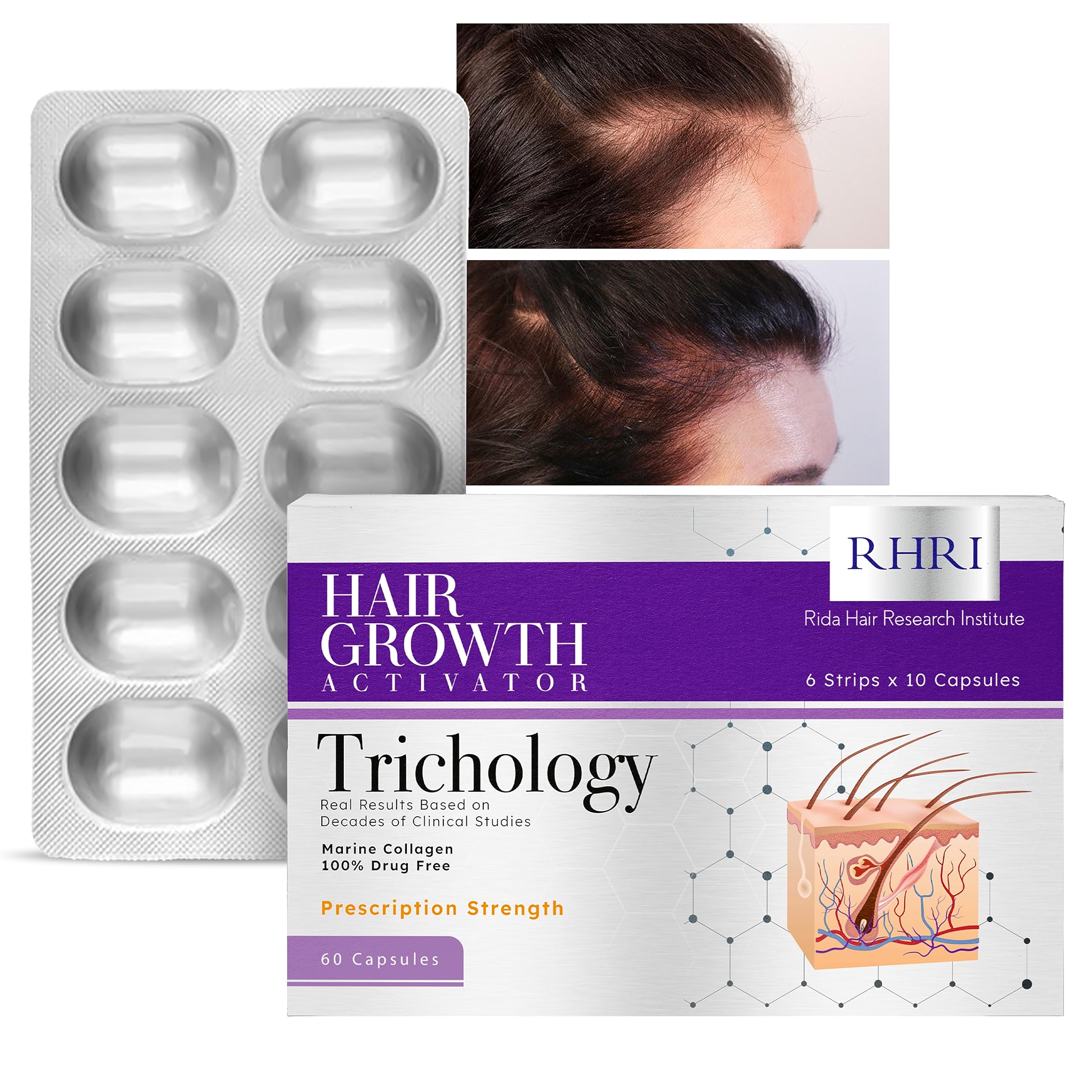 Details 153+ hair capsules for hair growth super hot camera.edu.vn