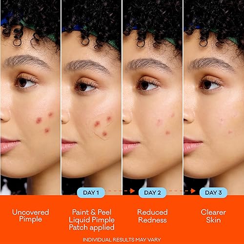Miniatura 4 de Bioré Parche líquido para pintar y pelar, parche invisible para espinillas con ácido salicílico, hasta 100 usos, 0.5 onzas