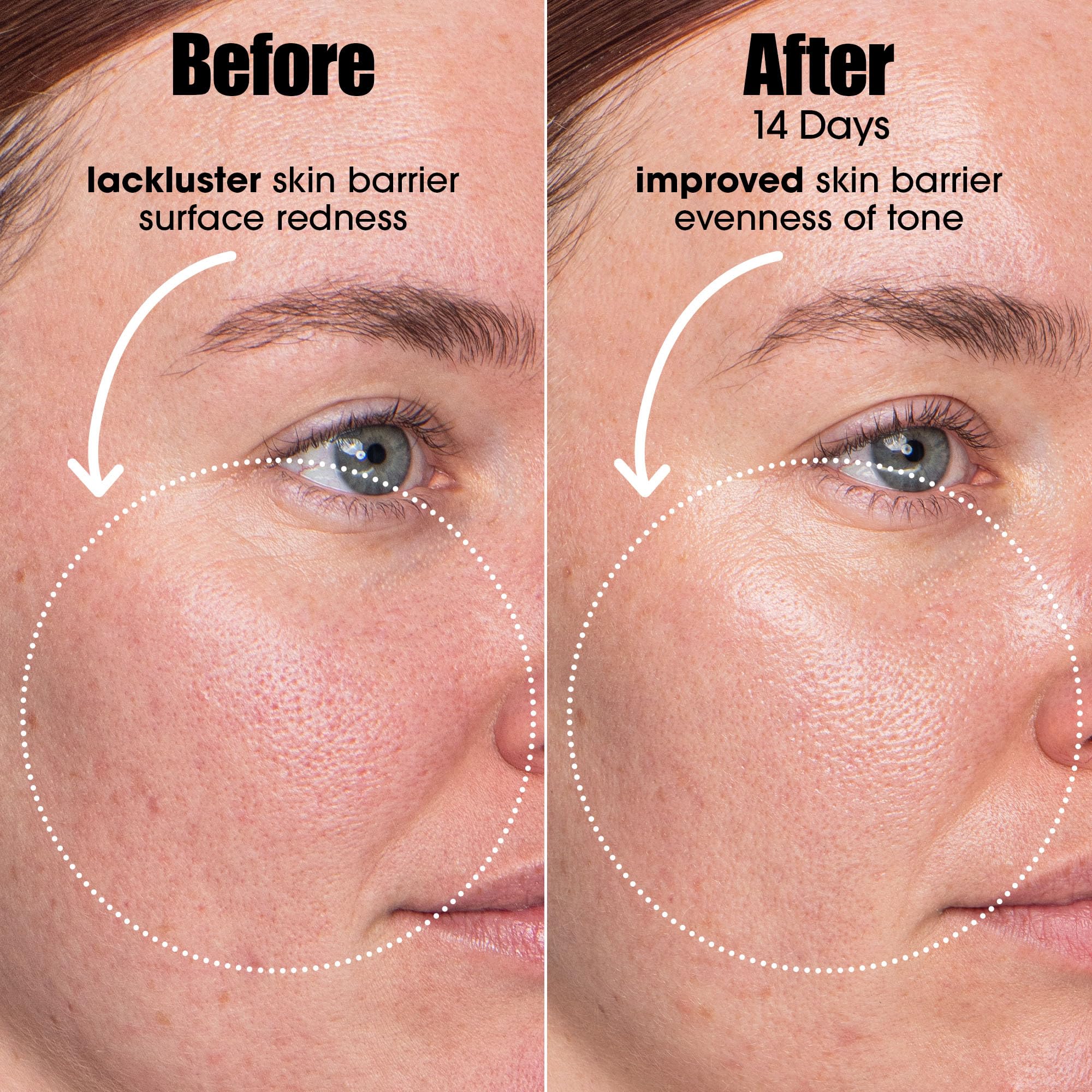 Sunday Riley A.I. Adaptive Retinoid Serum For Blemish Prone Skin