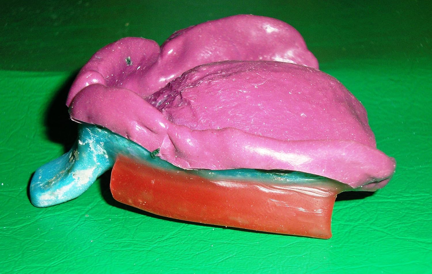 Dimensional Accuracy of Polyvinyl siloxane and Tissue Conditioning as Functional