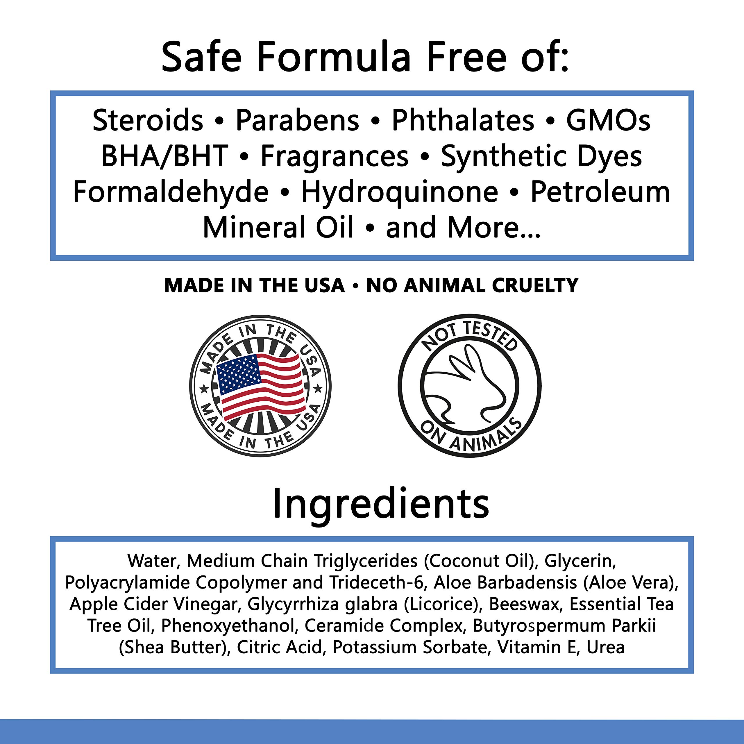 Eczema Cream for Adults & Kids Treatment for Dermatitis, Psoriasis