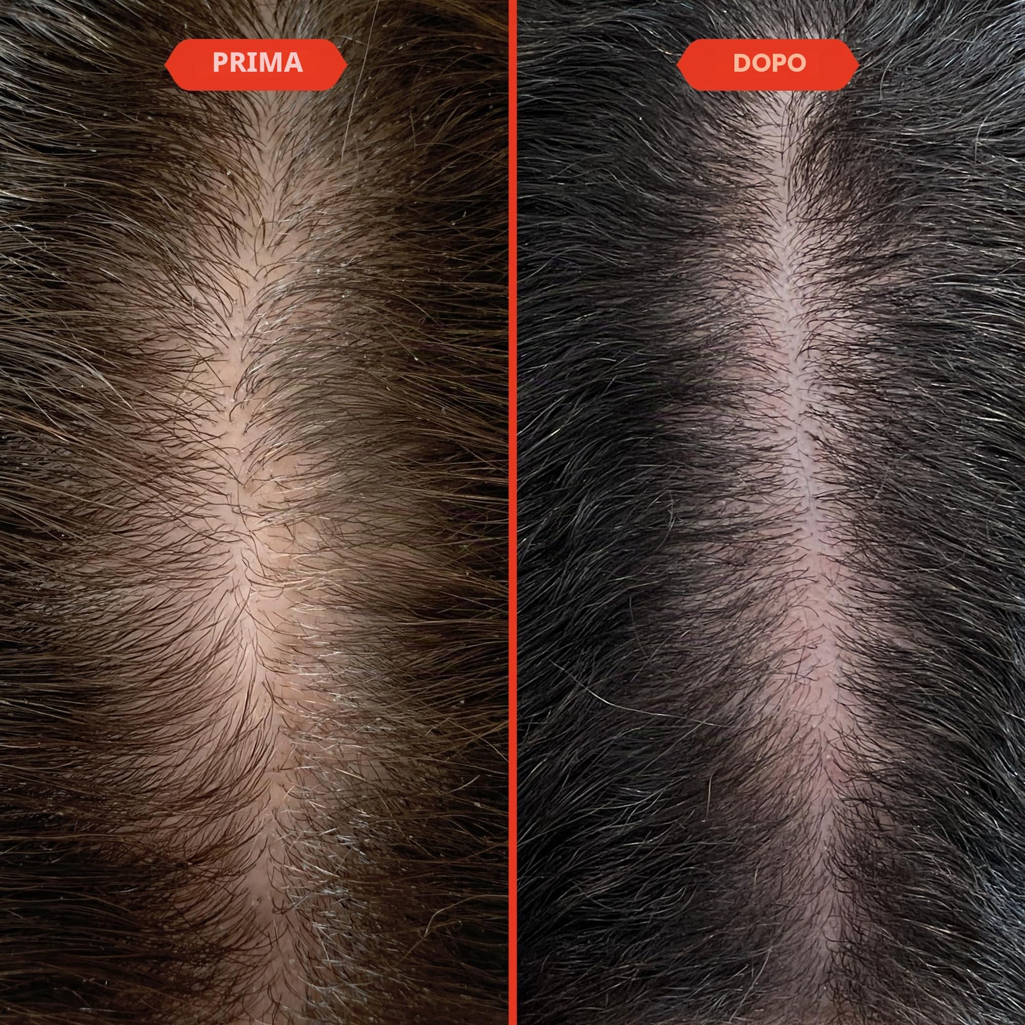 Fable & Mane HoliRoots - Olio per capelli, rinforza e ripara capelli secchi e danneggiati e cuoio capelluto, trattamento prelavaggio con amla e olio di ricino (100 ml)