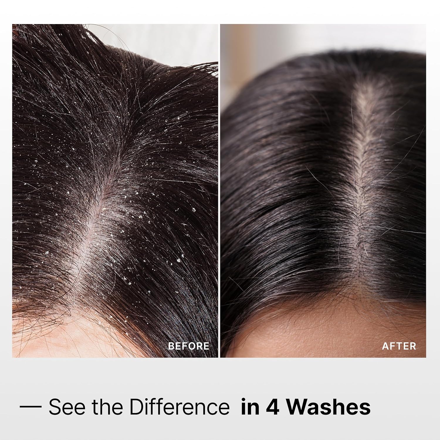 My Way Hair DNA Detox Shampoo – Deep Clarifying Formula for Product Buildup, Scalp Health Balance, and Damage Repair – Paraben, Phthalate, Sulfate, and Cruelty-Free Hair Care (8 oz)