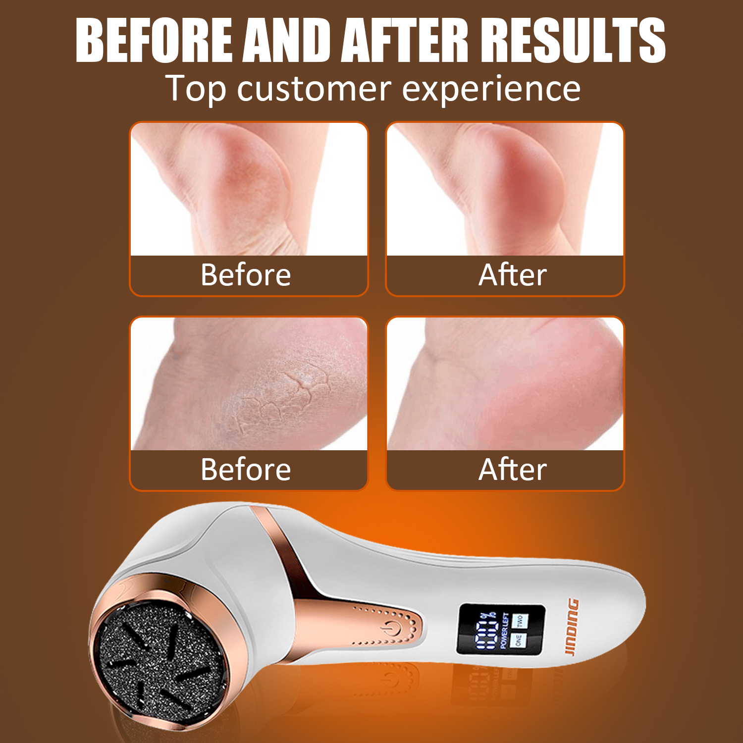 TanSon Electric foot Callus Removers 10 in 1 on Amazon Live