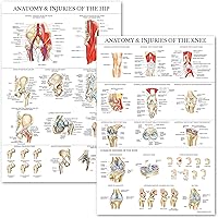 Vista 1 de Palace Learning 2 Pack - Anatomy and Injuries of The Knee & Hip Poster Set - Anatomical Chart Set - Laminated 18" x 24