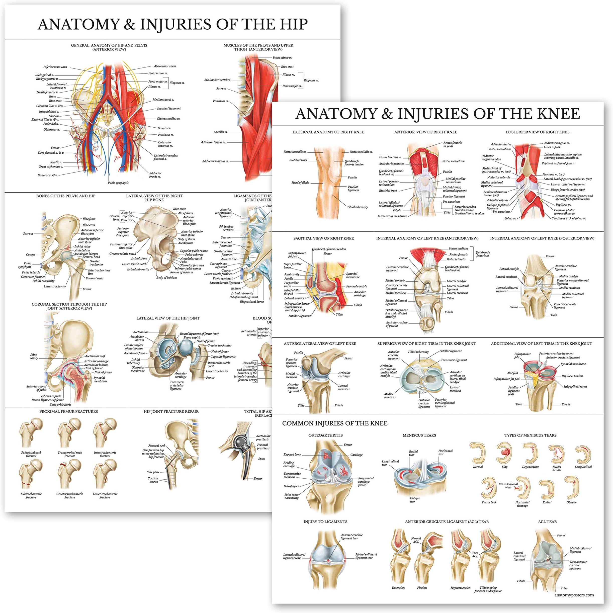 Palace Learning 2 Pack - Anatomy and Injuries of The Knee & Hip Poster Set - Anatomical Chart Set - Laminated 18" x 24"