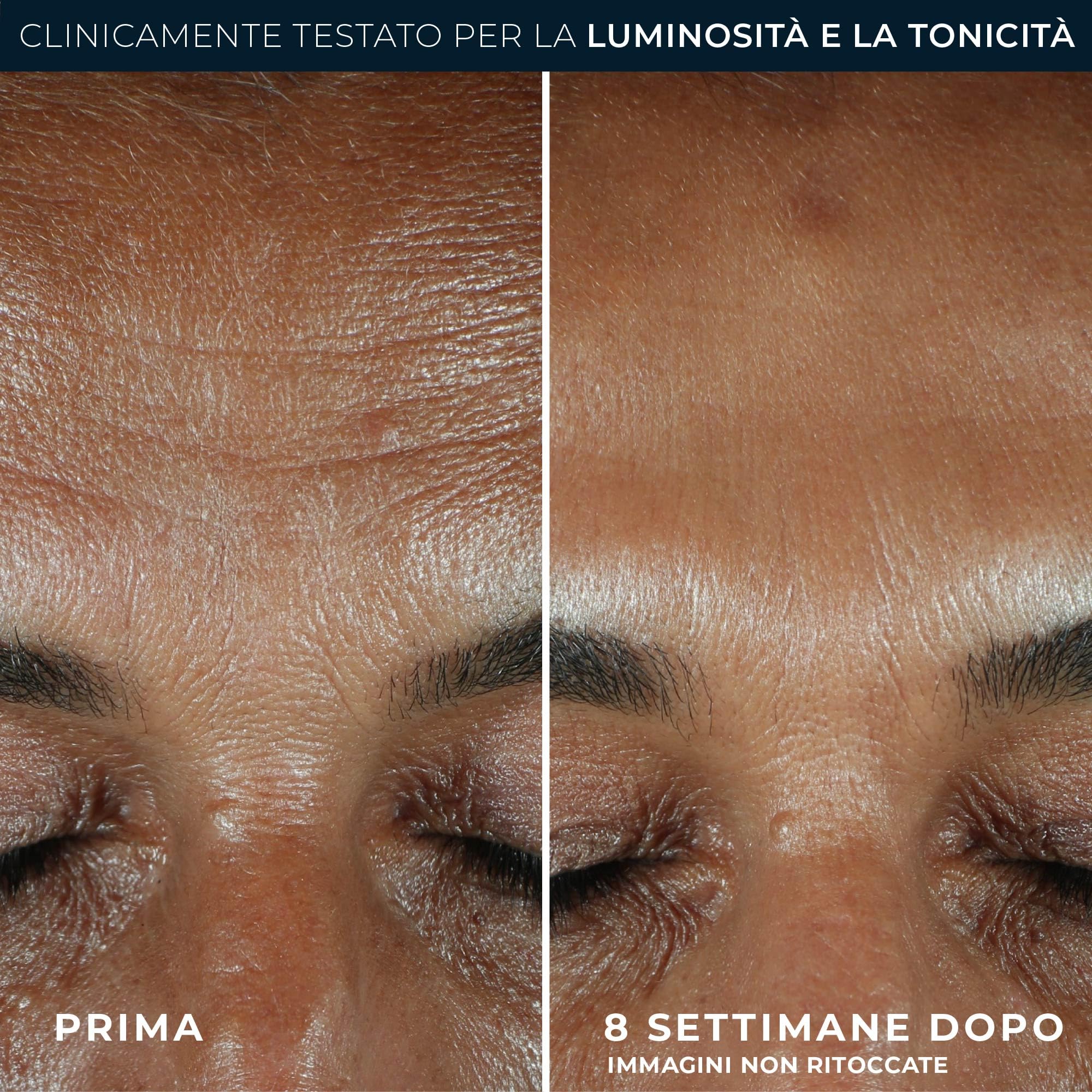 RoC - Multi Correxion Revive + Glow Siero Quotidiano Vitamina C - Anti Rughe e Invecchiamento - Crema Idratante Rassodante - 30ml