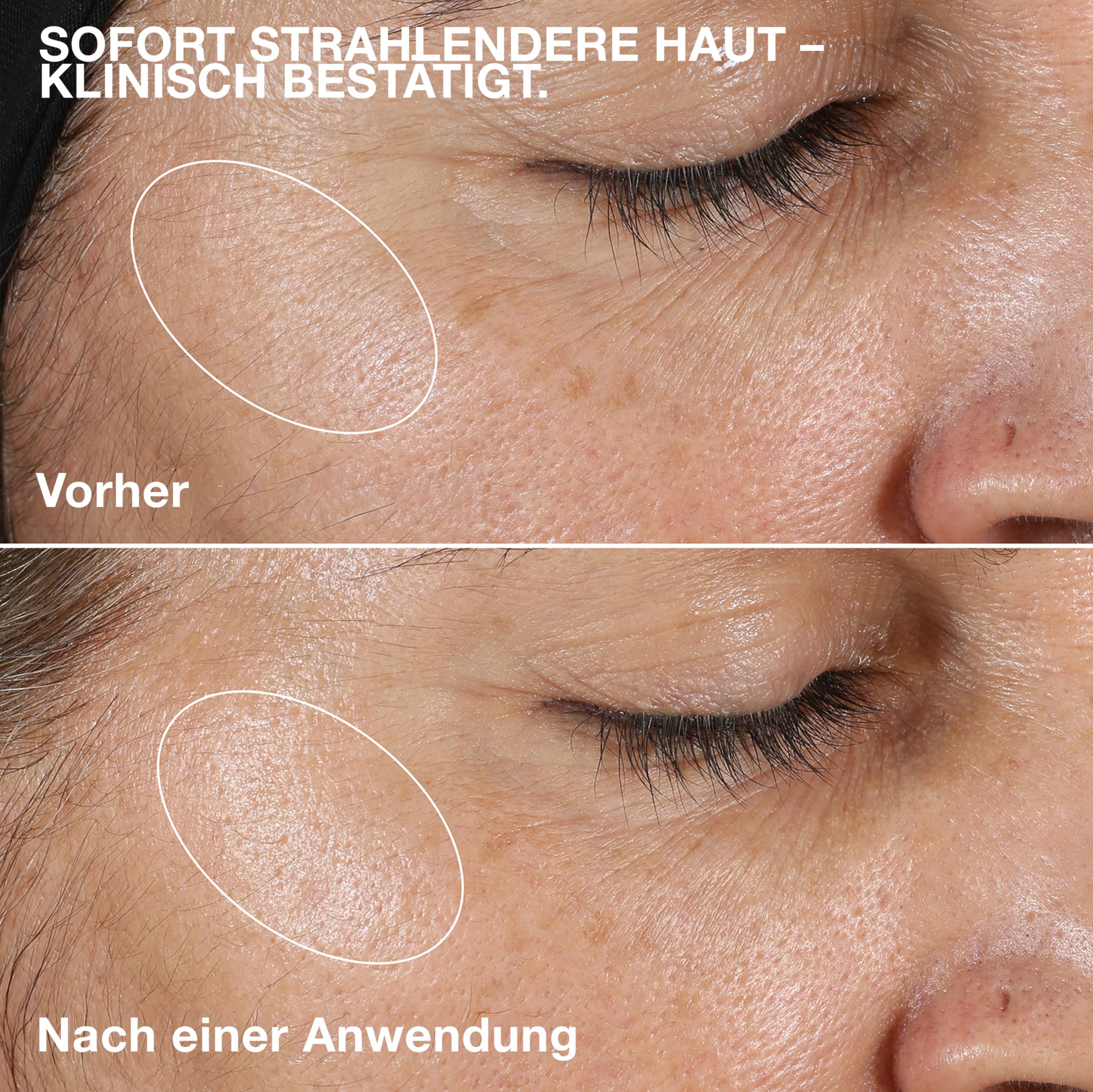 Clinique Clarifying Lotion 2 | Peeling-Lotion | Für trockene Mischhaut | Sanftes tägliches Peeling