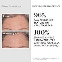 Vista 4 de Murad Conjunto de valor de tratamiento de resurgimiento