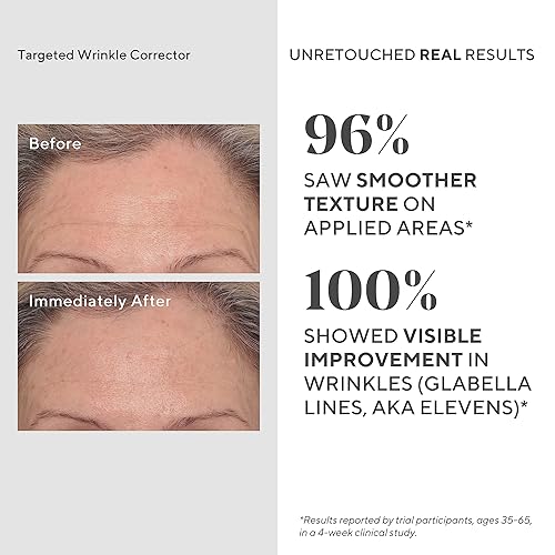 Miniatura 4 de Murad Conjunto de valor de tratamiento de resurgimiento