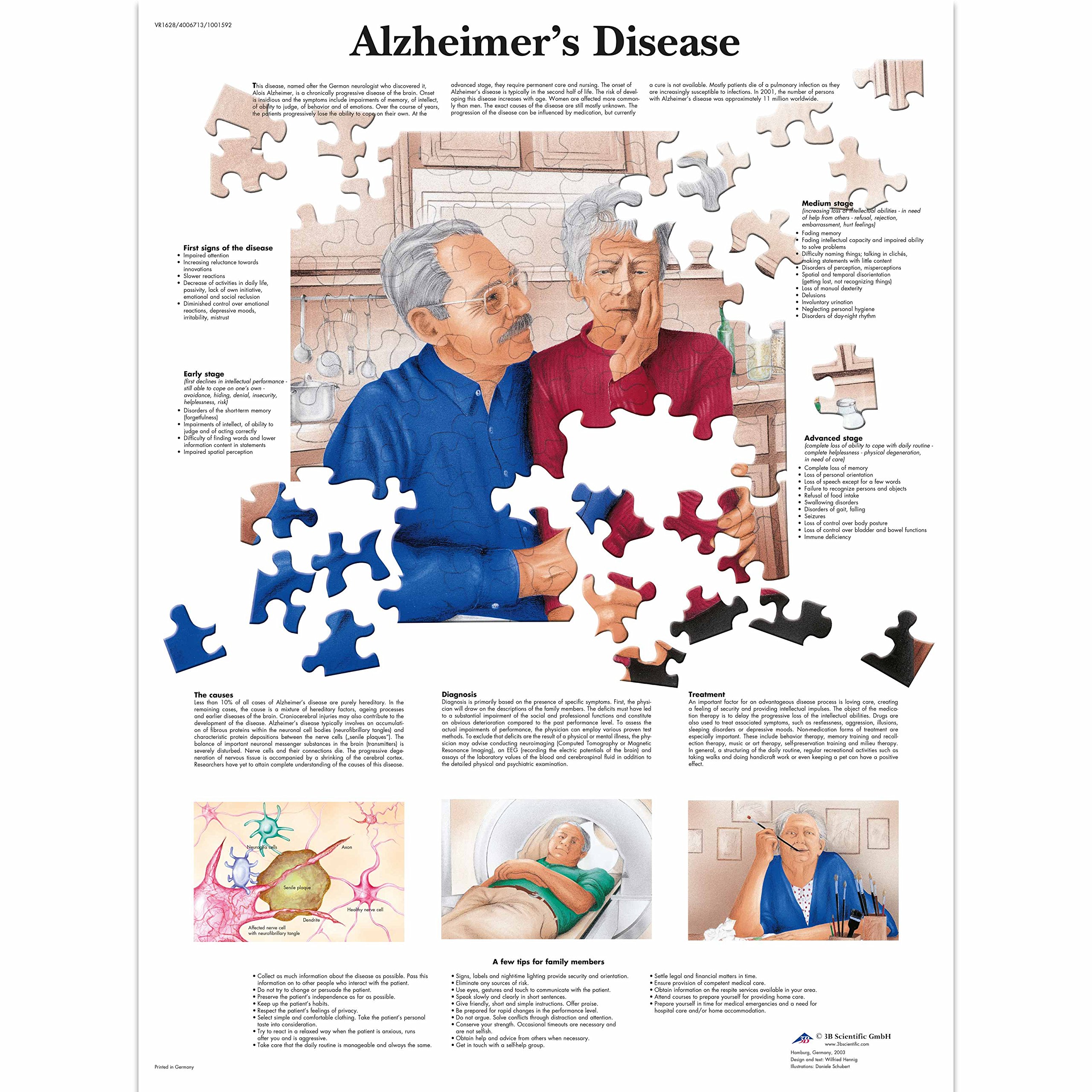3B Scientific Human Anatomy - Alzheimer's Disease Chart, Paper Version, unlaminated