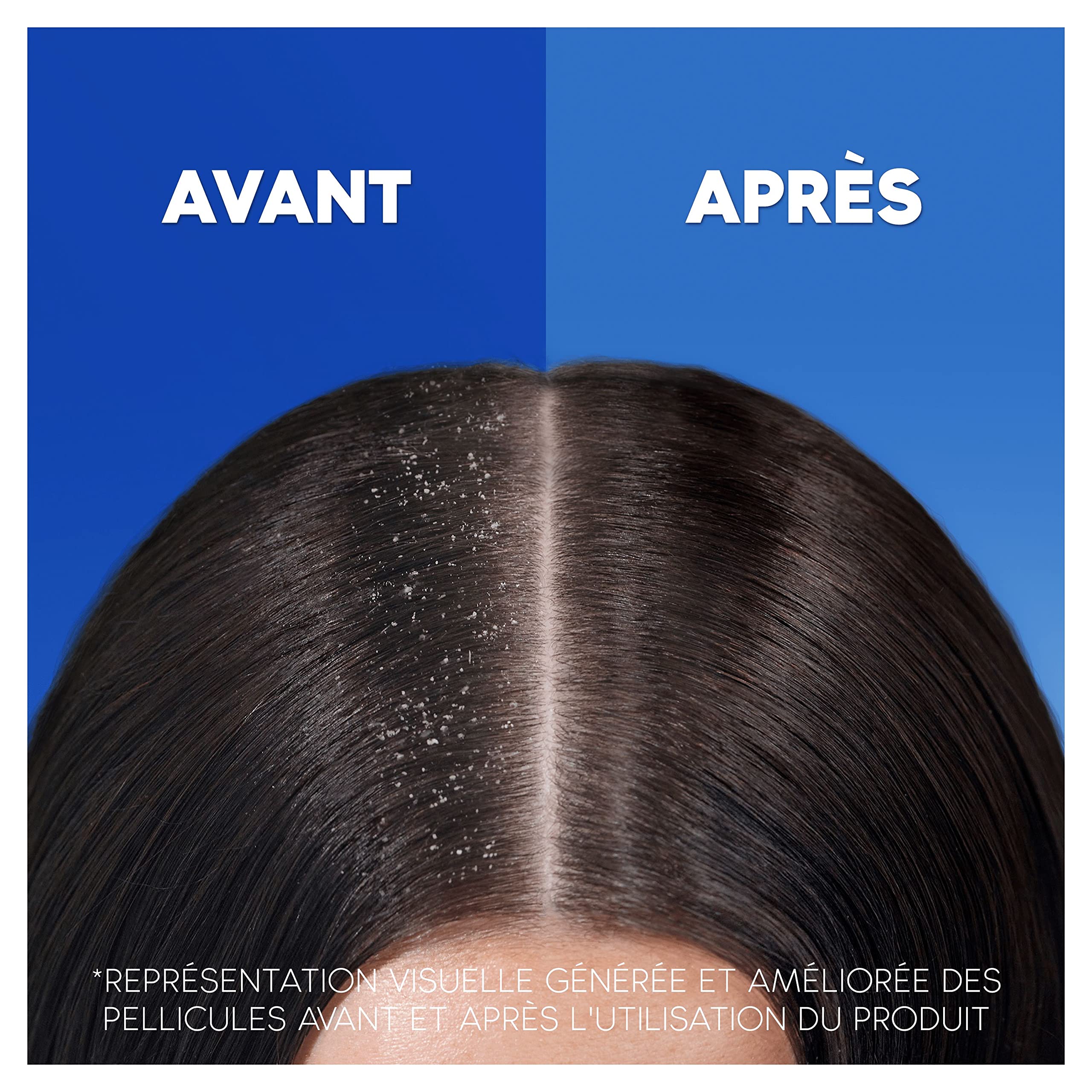 Head & Shoulders Shampooing Antipelliculaire Classic, Recharge 6 x 550 ml, Jusqu’à 100% des Pellicules Éliminées, Cliniquement Prouvé, Testé Sous Contrôle dermatologique
