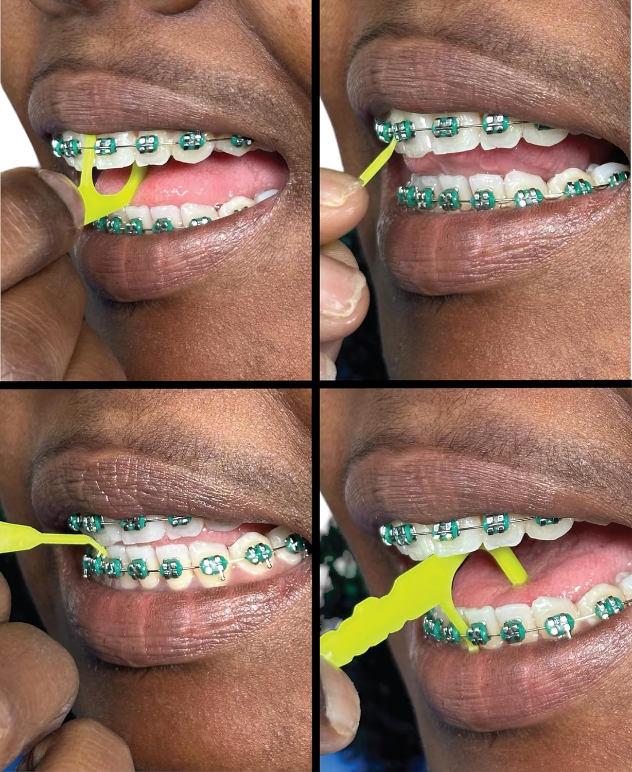 Braces Toothbrush Rechargeable with 4 Heads Bonus 2 AFTERCARE