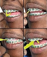 Vista 8 de Braces Cepillo de dientes recargable con 4 cabezales Bonus 2 AFTERCARE