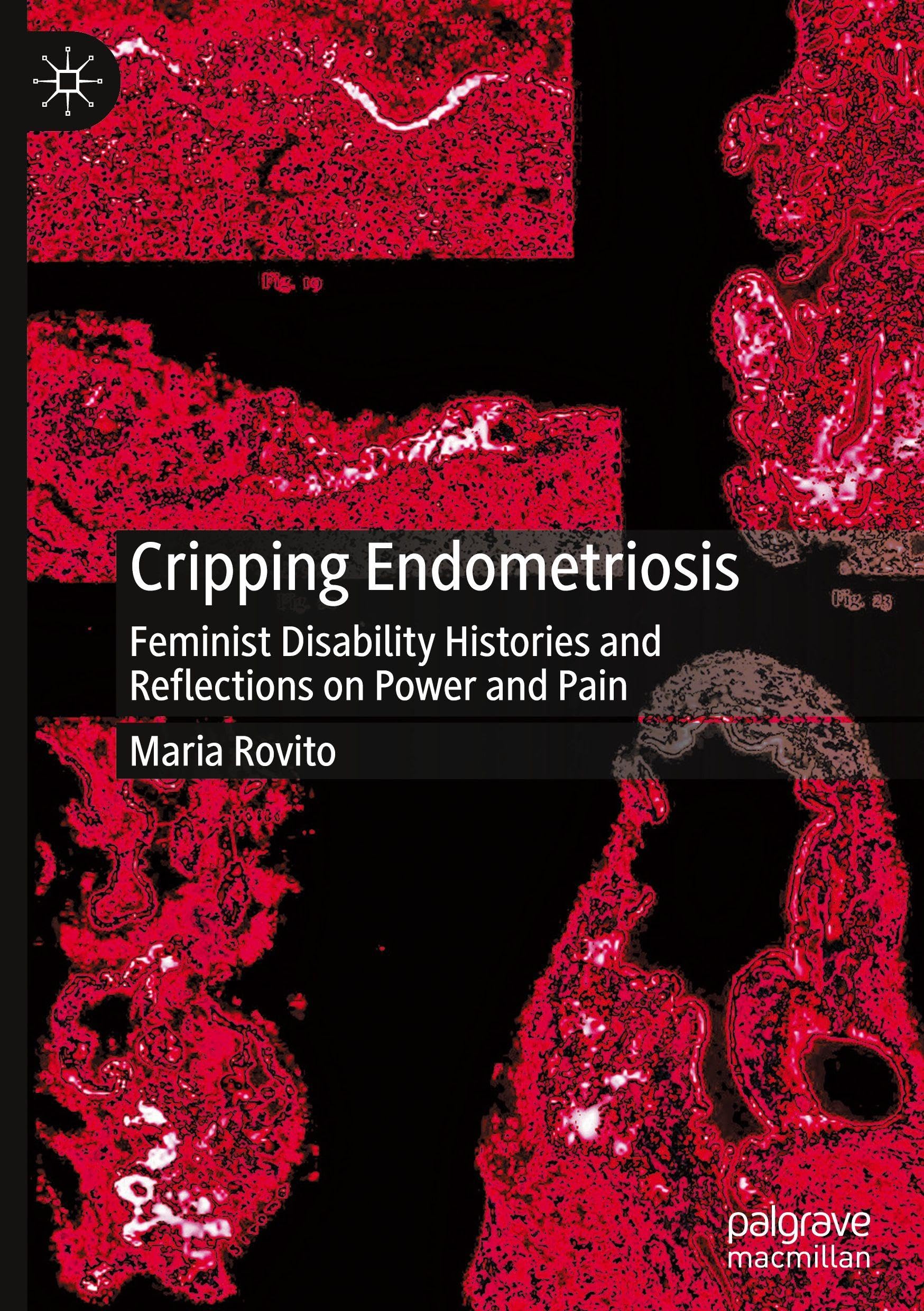 Cripping Endometriosis: Feminist Disability Histories and Reflections on Power and Pain