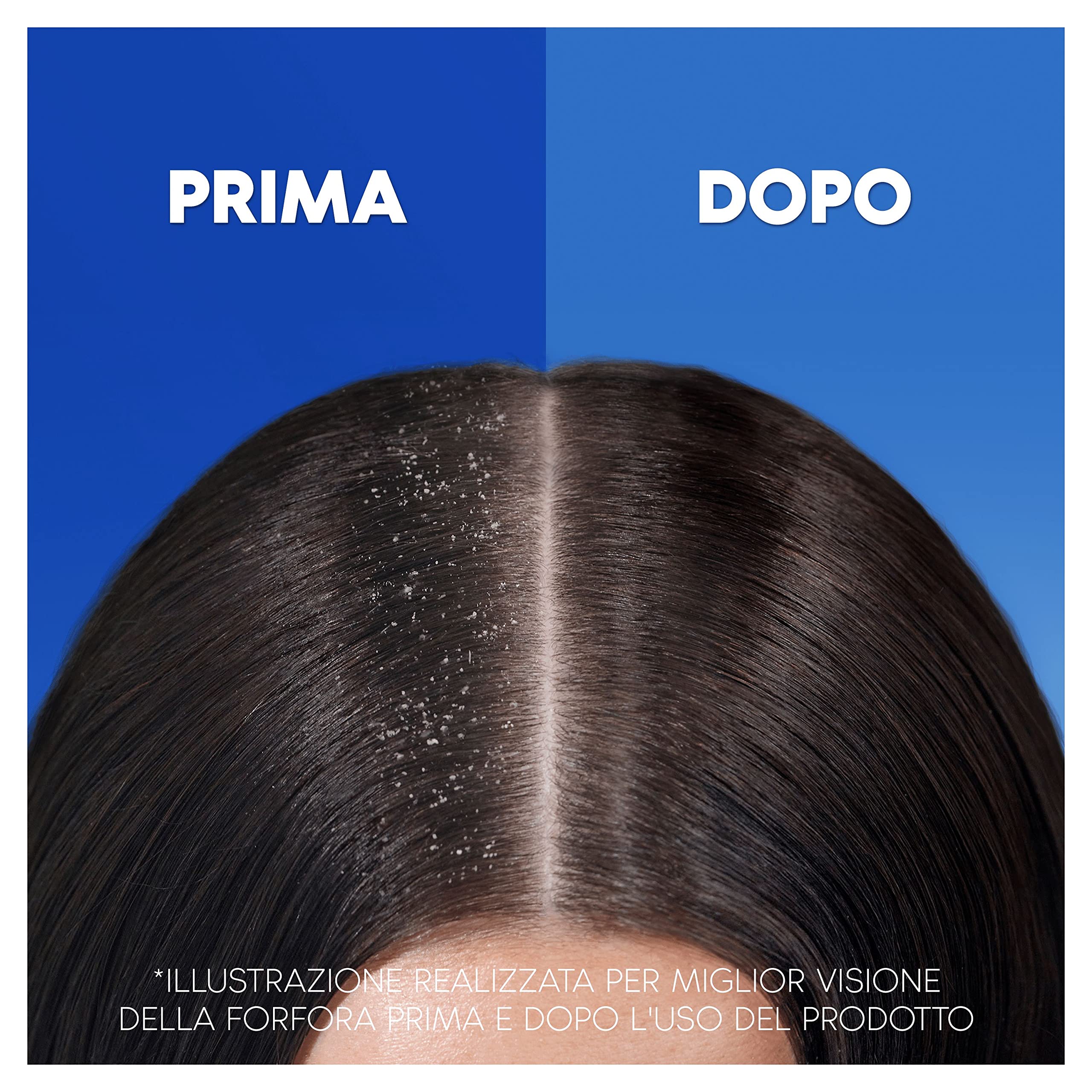 Head & Shoulders Antiforfora Shampoo e Balsamo 2in1 Classic Clean, Per Capelli Grassi, Protezione dalla Forfora per Cute e Capelli, Clinicamente Provato, Dermatologicamente Testato, 225ml