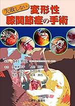 失敗しない変形性膝関節症の手術 伊東 美栄子、 上村 民子、 鈴木 啓司、 萩原 敬一、 橋本 章吾、 柳澤 真也; 木村 雅史 失敗しない変形性膝関節症の手術 伊東 美栄子、 上村 民子