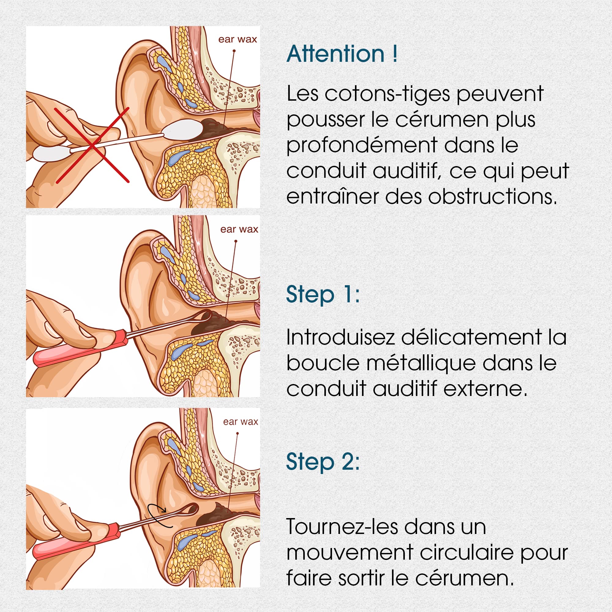 REMOS Cure-oreilles en acier inoxydable pour enlever le cérumen 14 cm satin