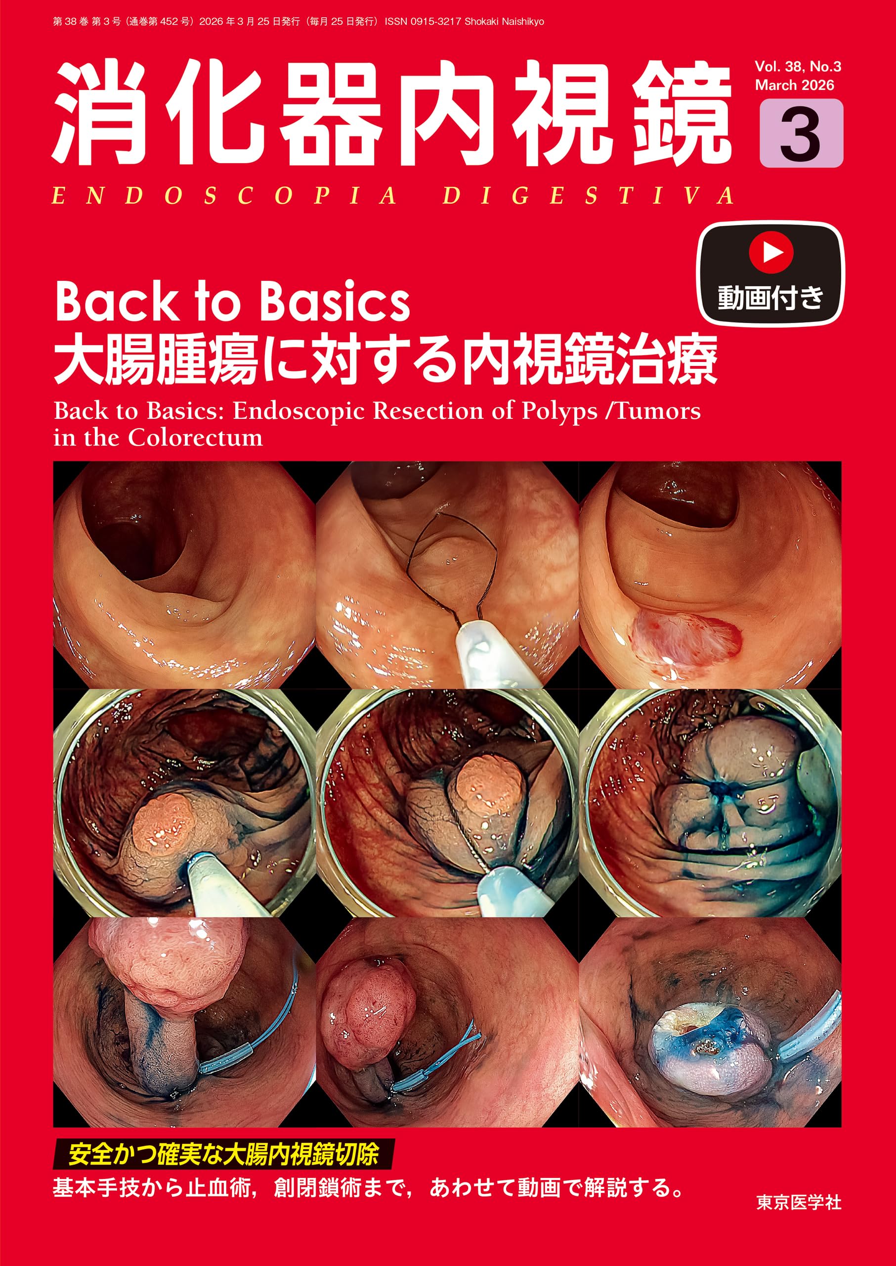 消化器内視鏡38巻3号2026年3月号 Back to Basics大腸腫瘍に対する内視